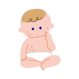 肌荒れしている赤ちゃん_xf7885601734m
